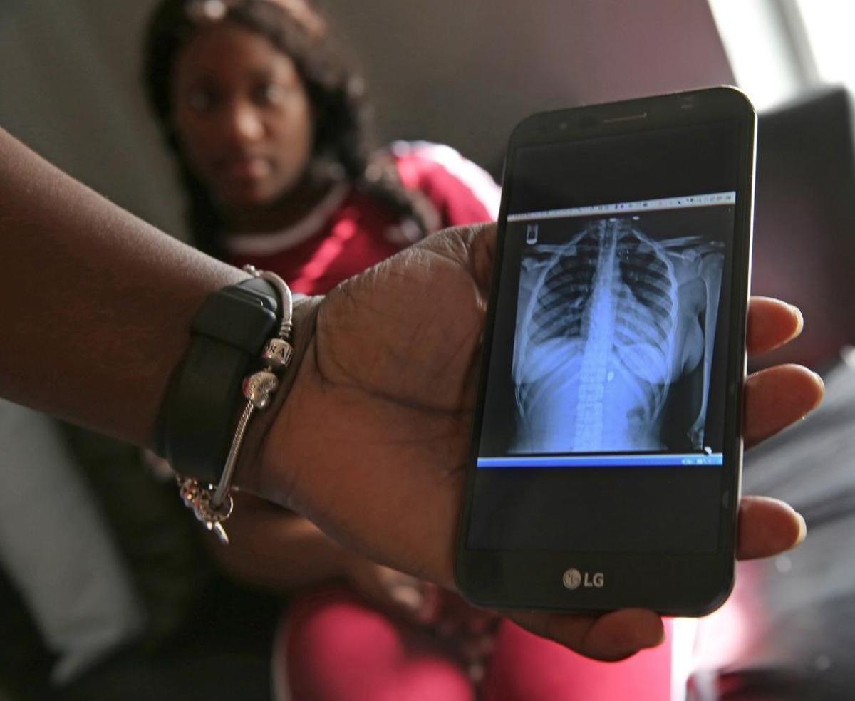 Quanisha Hepburn’s mother shows an x-ray of a bullet still lodged in her 18-year-old daughter’s body. Quanisha was an innocent bystander shot earlier this year but somehow managed to graduate from high school. She is now looking for help her find a job.