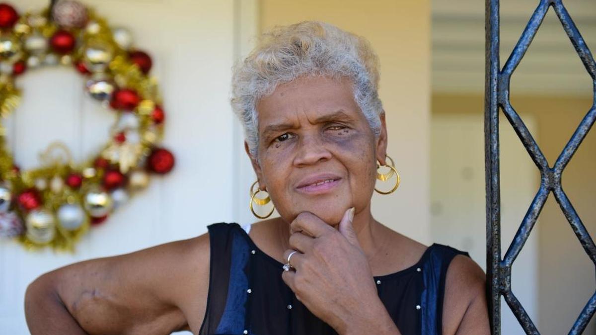 Joanna Colon-Espino, 55, outside the front of her West Park home. . Colon-Espino’s health problems necessitated the removal of her left eye. Her holiday wish is a prosthetic eye, which costs about $3,000.