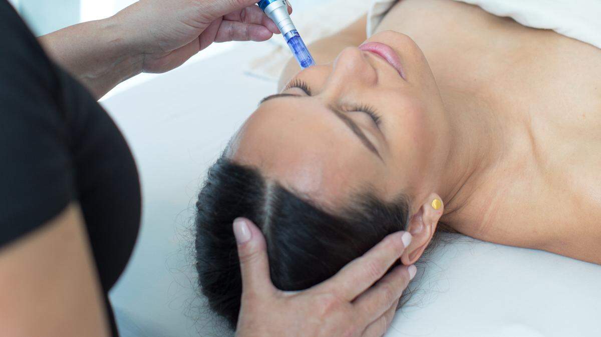 Microneedling has become one of the most popular anti-aging cosmetic treatments. Dermatologists use it for treating fine lines and wrinkles, as well as acne scars.