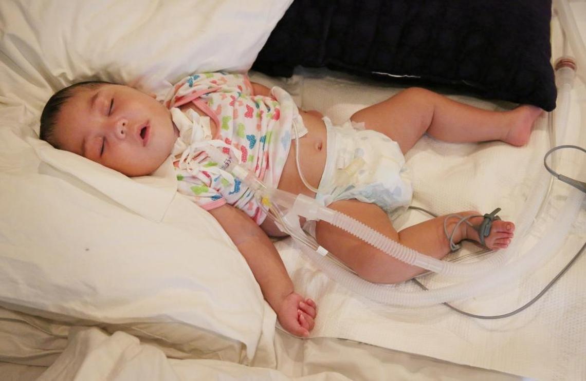 Victoria Malave, 10-months-old, requires a breathing tube, suction machine, feeding tube and pulse oxygen monitoring. She and her mother Maricelis Jimenez, 38, were airlifted out of Puerto Rico after Hurricane Maria to seek medical care in South Florida.