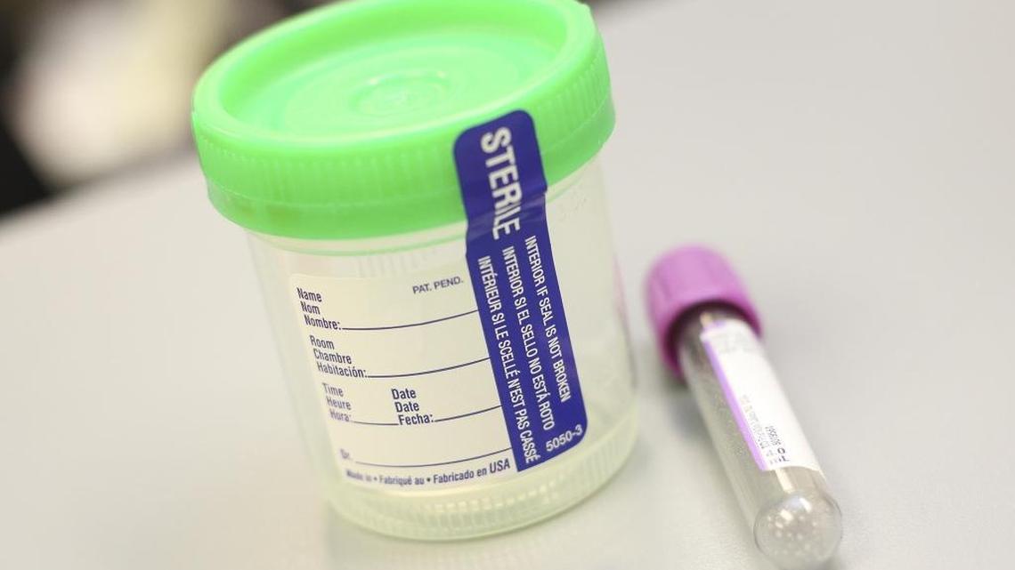 A typical Zika virus test kit will include a blood and urine sample like the ones pictured here. This week, the Florida Department of Health is offering free Zika testing to all individuals who live and/or work in a section of Miami Beach where mosquitoes are actively spreading the virus between 8th and 28th Streets from the ocean to Biscayne Bay.