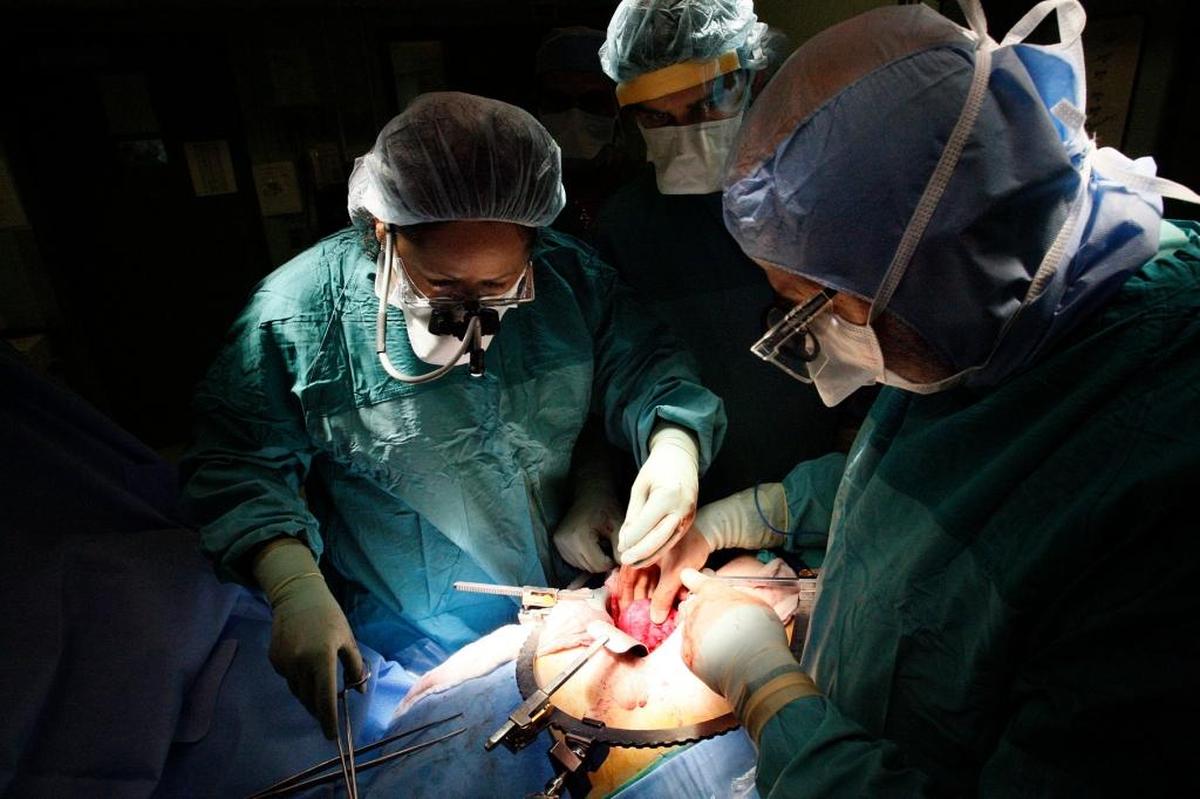 In this July 2008 photograph, University of Miami transplant surgeons prepare to remove a healthy kidney from a patient at the Miami Transplant Institute, a partnership program between the UM Health System or UHealth and Jackson Health System, Miami-Dade’s public hospital network. On Tuesday, Jackson Health trustees approved a five-year agreement with UHealth for transplant services at MTI. The deal is capped at about $7 million a year.
