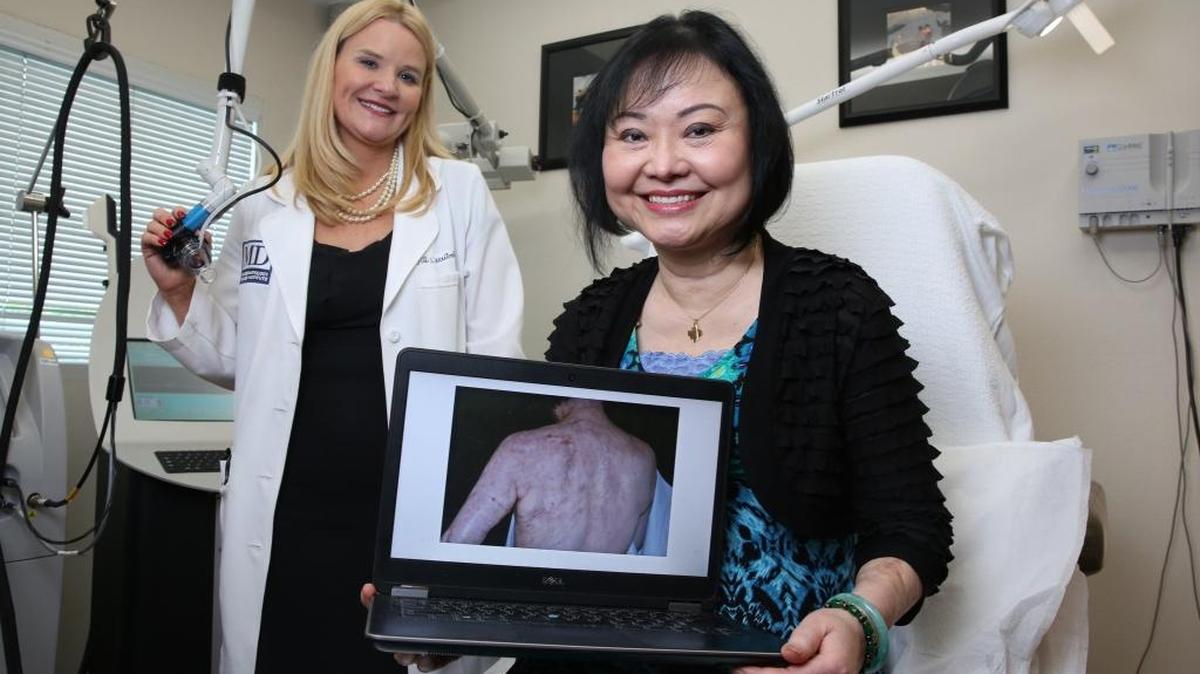 Kim Phuc Phan Thi, 53, known by many as the"Napalm Girl" after being photographed at the age of 9, fleeing a napalm attack during the Vietnam War. She was badly burned in the attack and has recently undergone laser treatments in Miami to help remove the scars from her skin. Kim Phuc was all smiles Friday, in Miami on Jan. 9, 2017, where she was preparing for her final laser treatment from Dr. Jill Waibel of the Miami Dermatology and Laser Institute. Kim Phuc holds a laptop showing one of the first photos taken of her back by Dr. Waibel before all of the healing Lumenis Ultra Pulse laser treatments she has received.