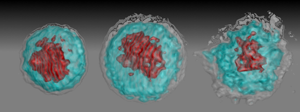 Images (left to right) of a healthy white blood cell, a cell infected by African Zika virus and a cell infected by Asian Zika virus show how Zika works to weaken the body’s immune response.