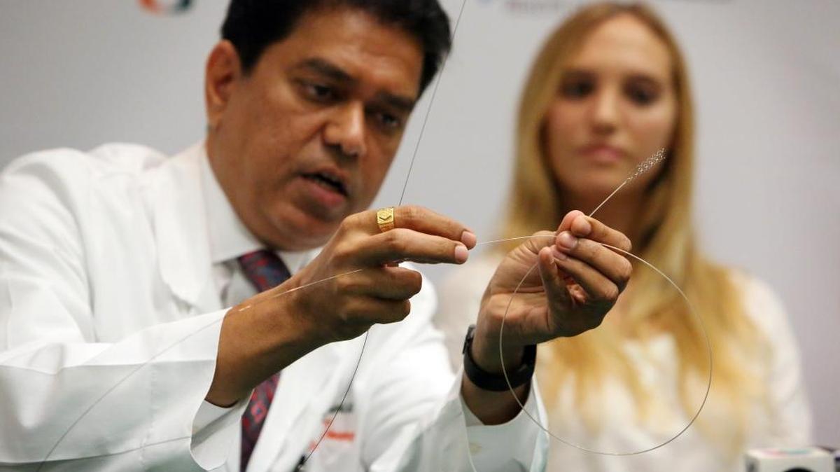 In this September 2015 photo, Dr. Dileep R. Yavagal, chief of interventional neurology for the University of Miami Health System, demonstrates how by using a stent device, he was able to grab a clot inside of the blocked brain artery in a stroke victim, Isabel Vinueza (right). A study published this week in the New England Journal of Medicine found that surgical removal of a clot plus standard care with clot-busting medication produced better outcomes for stroke patients with injured but viable brain tissue.