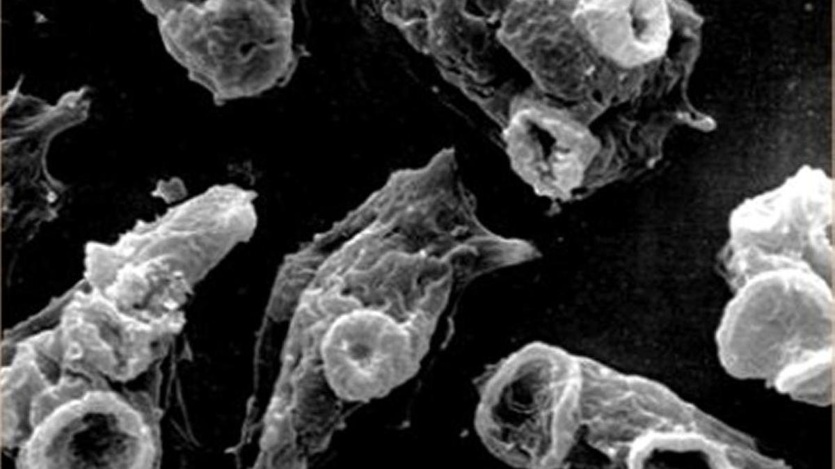Naegleria Fowleri, the brain-eating amoeba, seen under a microscope.