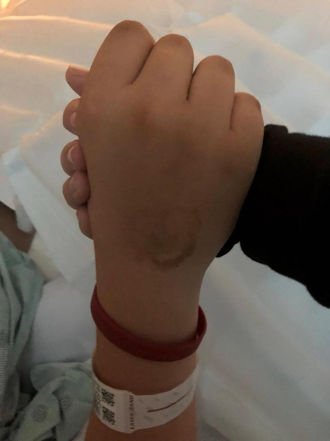 Marie Laman holds the hand of her son, 15-year-old Kyle Laman, after he underwent a nine-hour surgery to repair a massive wound to his ankle incurred during the Marjory Stoneman Douglas school shooting.
