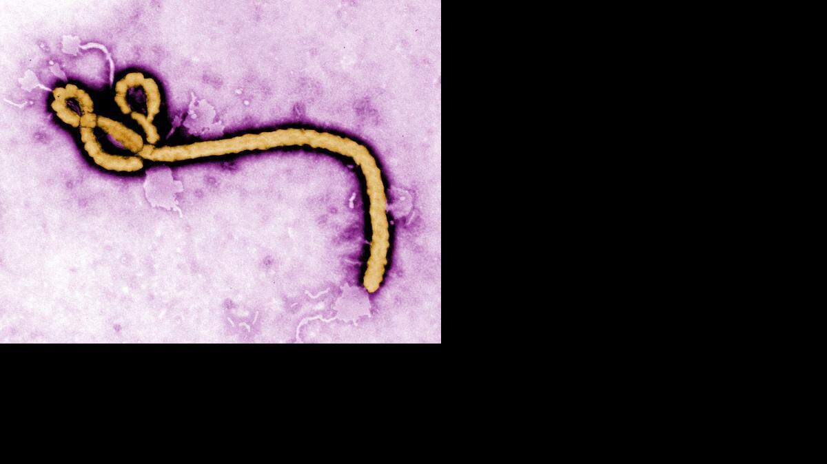 
A colorized transmission electron micrograph of a Ebola virus virion is seen in this handout photo from the Center for Disease Control.
