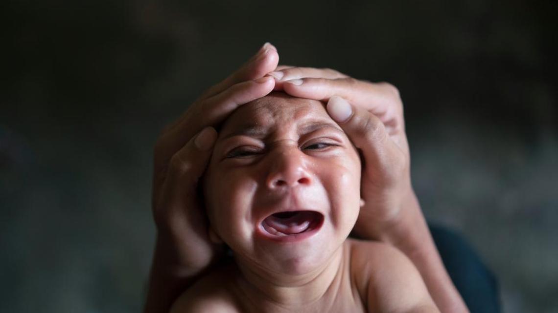 Jose Wesley, in Bonito, Pernambuco state, Brazil, was born with microcephaly, a rare neurological disorder linked to the Zika virus. He screams uncontrollably for long stretches, getting red in the face and tightening his already stiff limbs.