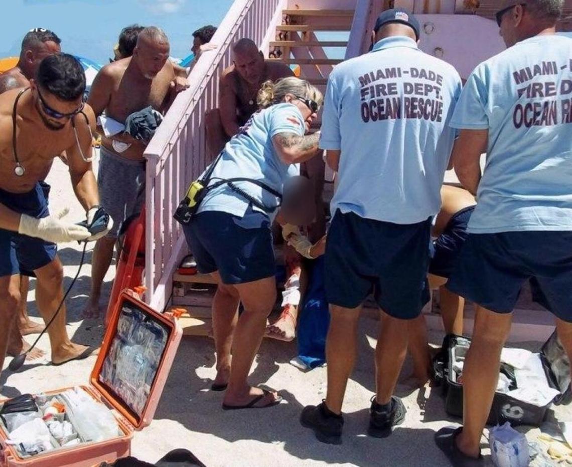 Miami-Dade Fire Rescue Ocean Rescue workers gives aid to a man who was bitten by a shark Sunday off of Haulover Beach.