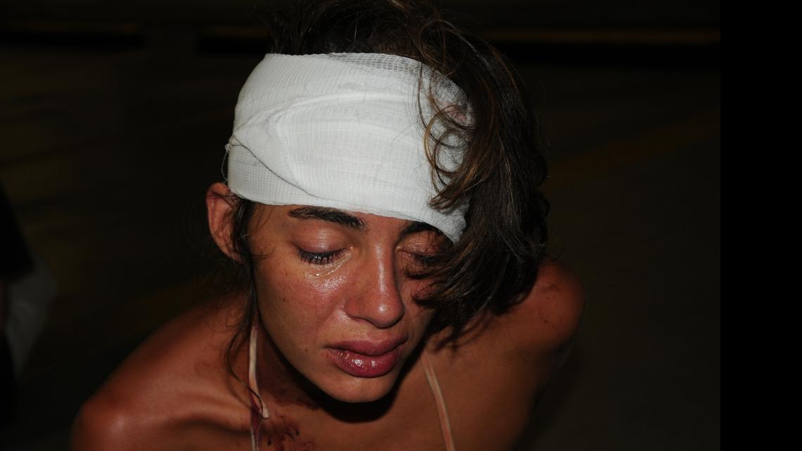 
Megan Amadescu is pictured after her arrest on June 26, 2013, with a bandage wrapped around her head. She was injured during her arrest, with a contusion to the back of her head and a bruise under her left eye, when Miami Beach Detective Philippe Archer said he hit her after she drunkenly slapped him during a struggle over her identification. Then after she was in handcuffs at the police station’s garage, she kicked Archer in the shin, who responded by punching her and kicking at her head— an incident captured in the video below.
