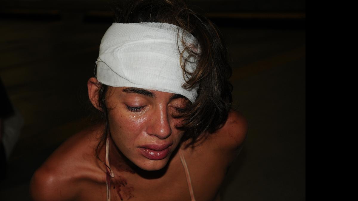 
Megan Amadescu is pictured after her arrest on June 26, 2013, with a bandage wrapped around her head. She was injured during her arrest, with a contusion to the back of her head and a bruise under her left eye, when Miami Beach Detective Philippe Archer said he hit her after she drunkenly slapped him during a struggle over her identification. Then after she was in handcuffs at the police station’s garage, she kicked Archer in the shin, who responded by punching her and kicking at her head— an incident captured in the video below.
