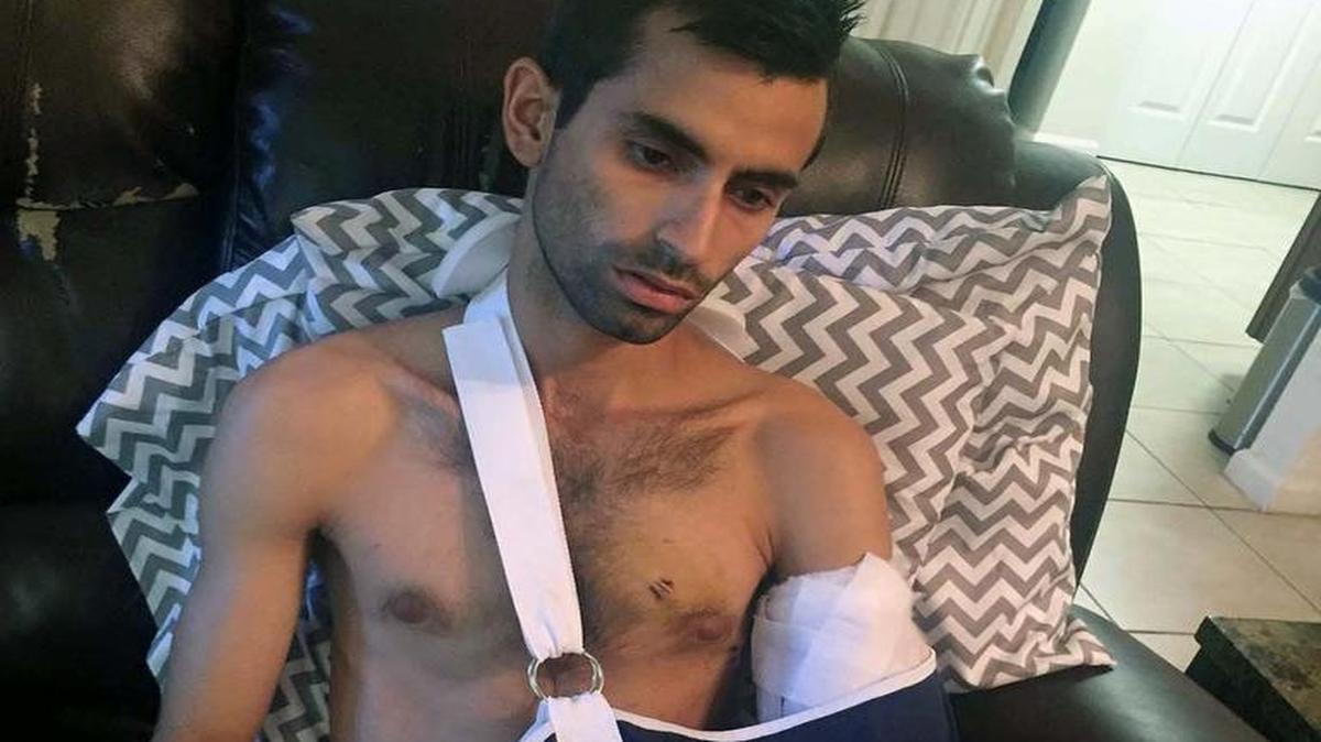 Reynier Miranda at his home in Southwest Miami-Dade on Thursday, Sept. 22, 2016. Miranda, a maintenance worker, was cleaning the hallway in the apartment complex where he lives last week when he was struck by a bullet that came from inside an apartment where Miami-Dade police officer Wanda Ramos accidentally discharged her gun.