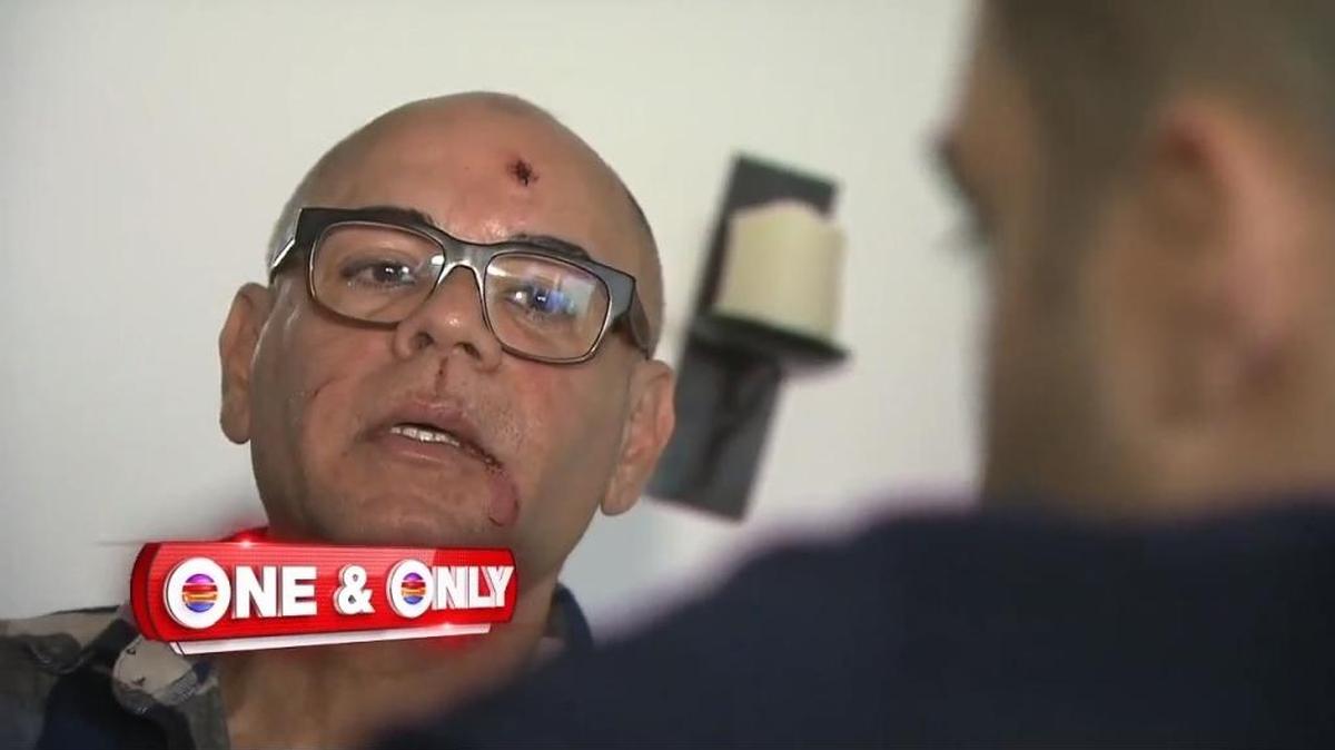 In this screengrab from WPLG 10, Jose Gonzalez said he hailed a shared Lyft ride outside South Beach’s Twist bar Thursday morning and a female passenger punched and kicked him in the car and hurled a homophobic slur when the driver said he was to be dropped off first. Miami Beach police are investigating.