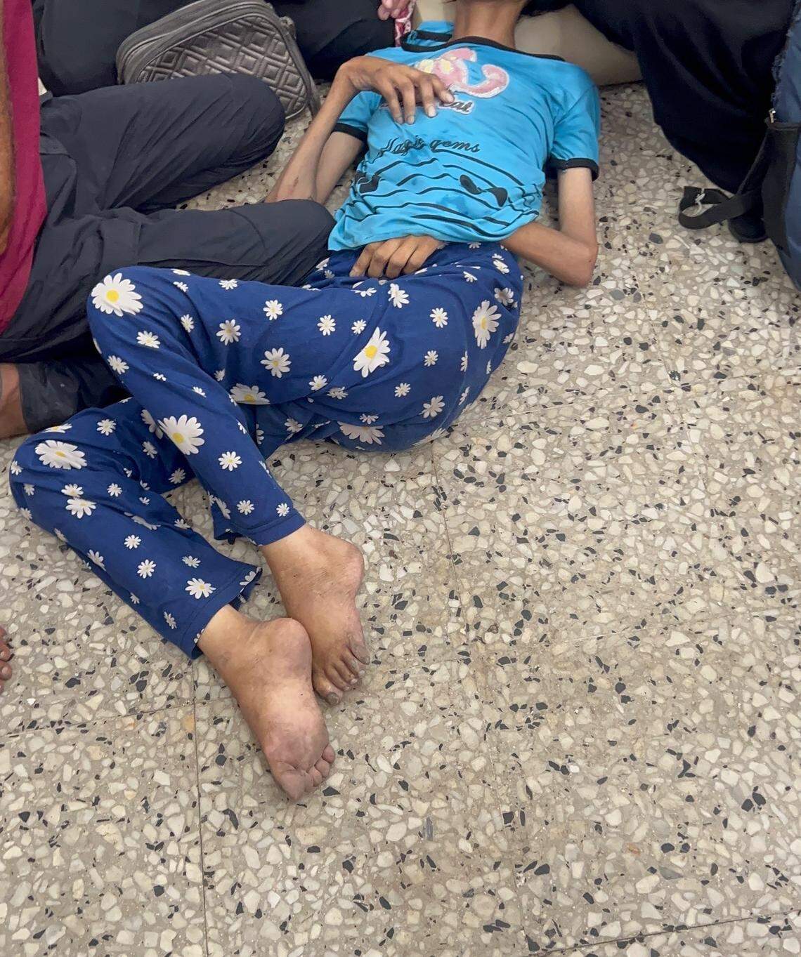 A 13-year-old girl suffering from malnutrition on Aug. 13 at Al-Shifa Hospital. “She died shortly after,” Ali said.