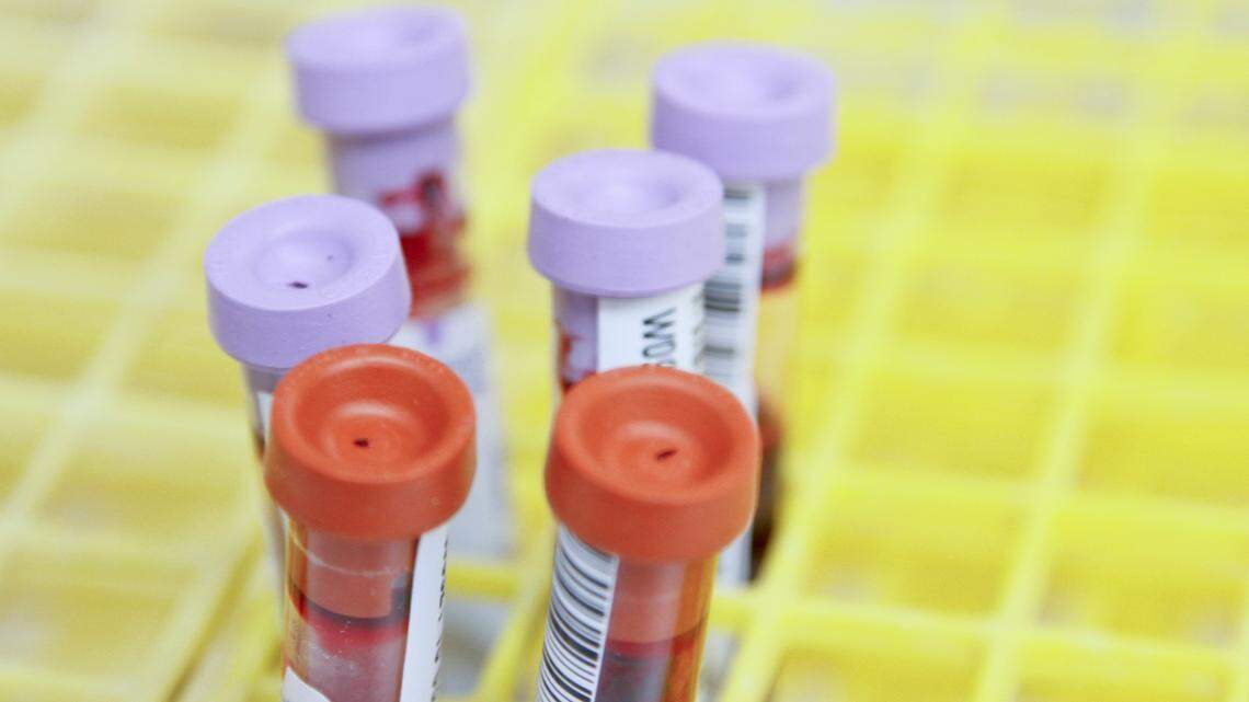 Scientists found that protein levels in the blood can predict dementia risk years before diagnosis.