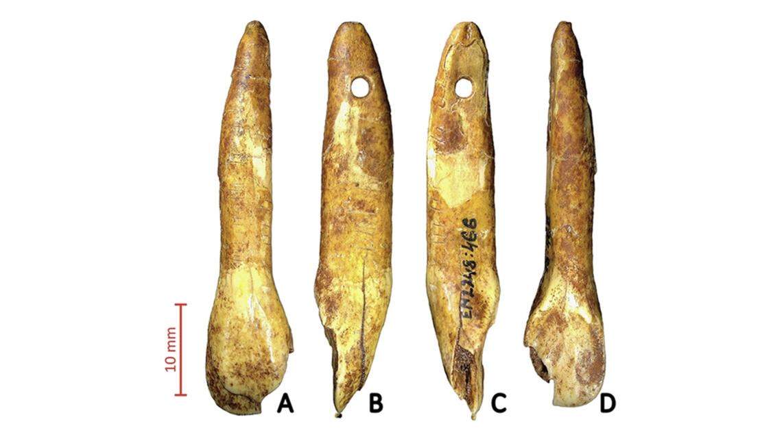 Archaeologists in Lithuania recently uncovered a rare tooth pendant that dates to between 9000 and 5000 B.C., according to a new study.