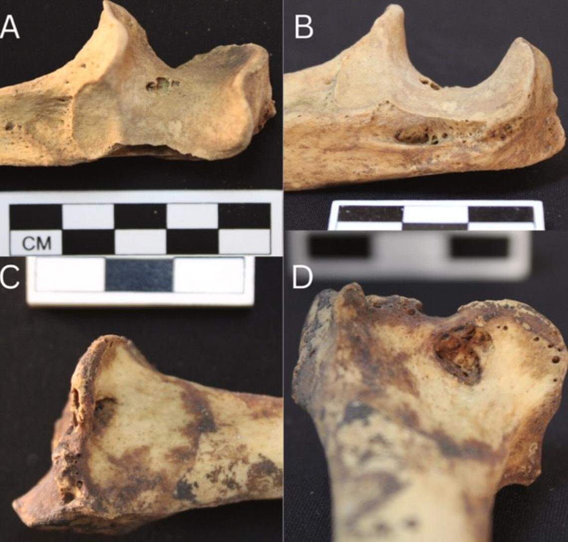 Skeletal remains of the woman with visible lesions