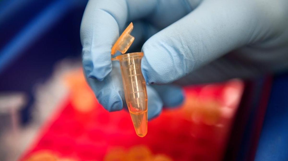 A new autism study from University of Warwick researchers published in the journal Molecular Autism found autism-linked protein damage in blood plasma that could make for a 90 percent accurate autism diagnostic test — which they found by comparing Italian children with an Autism Spectrum Disorder to children without.