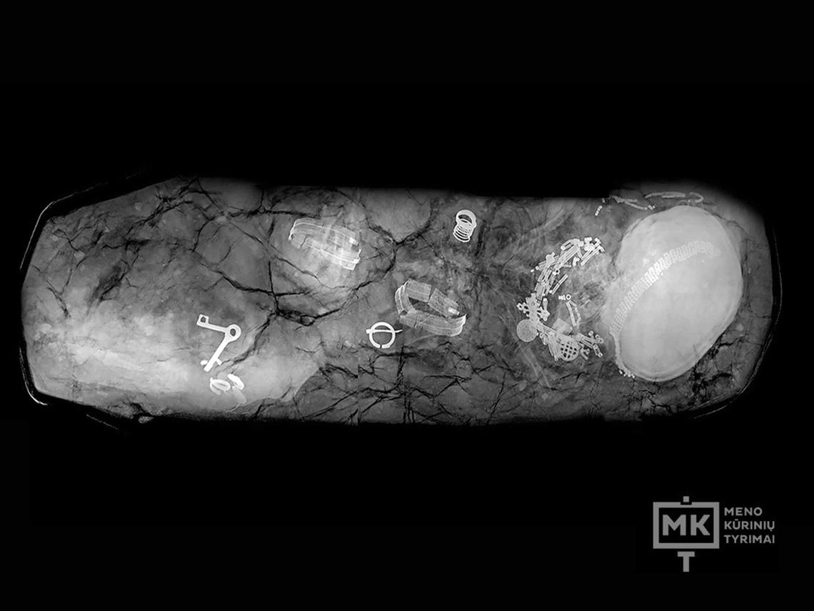 An X-ray shows the 600-year-old woman’s adornments. Her crowned head is on the right side.