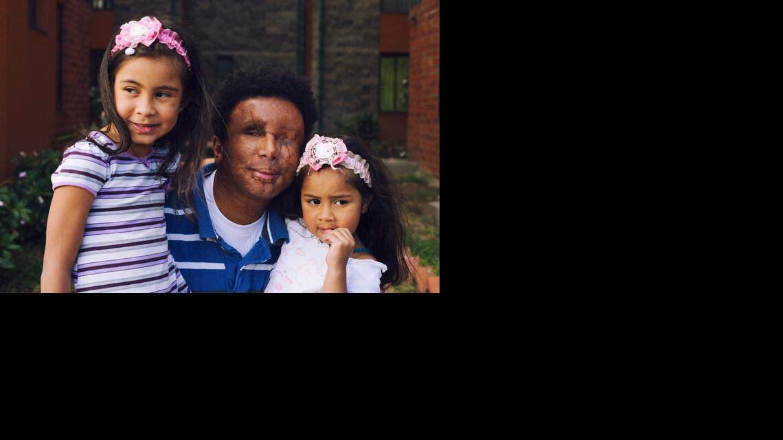 
Edgar Bermudez, 35, who was blinded in a 2005 attack by Colombia’s FARC guerrillas, poses with his two daughters Camila Sofia, 5, and Alisson Juliana, 3, outside his home. The government recognizes 6.7 million victims of the 50-year civil conflict. 
