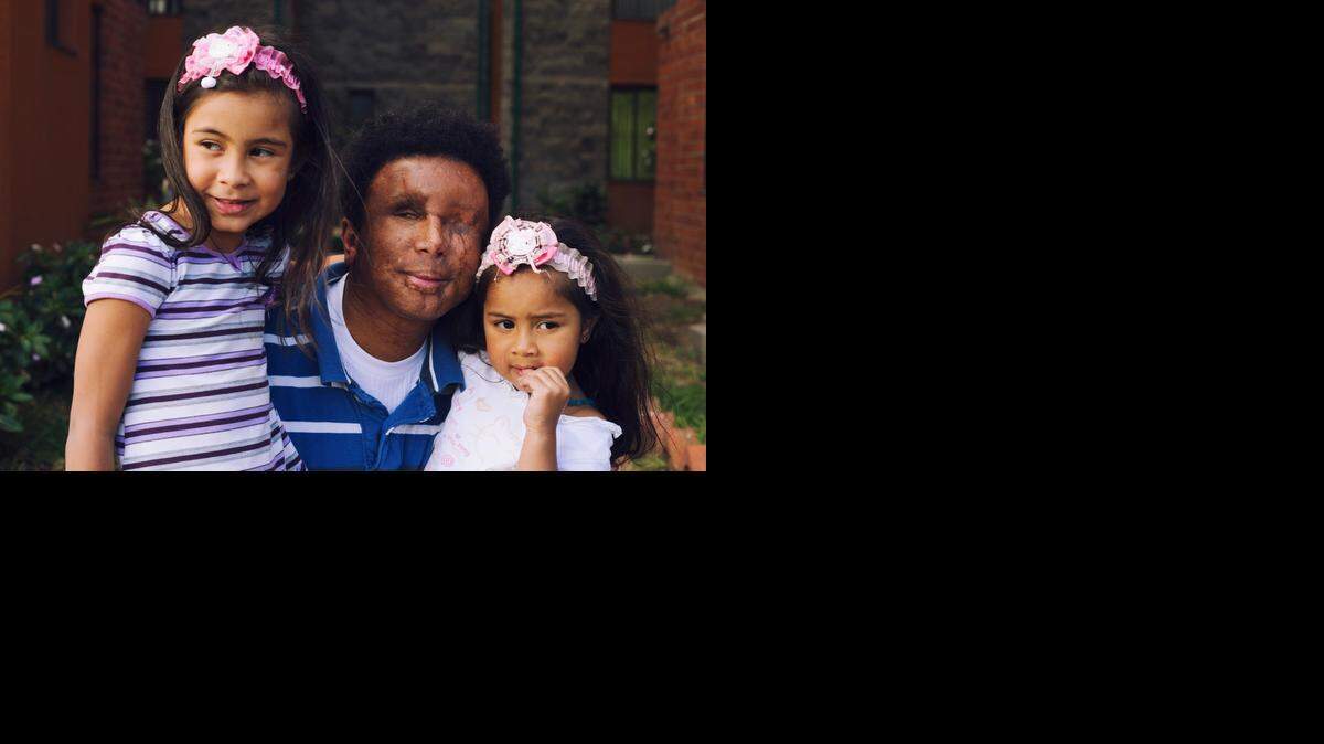 
Edgar Bermudez, 35, who was blinded in a 2005 attack by Colombia’s FARC guerrillas, poses with his two daughters Camila Sofia, 5, and Alisson Juliana, 3, outside his home. The government recognizes 6.7 million victims of the 50-year civil conflict. 
