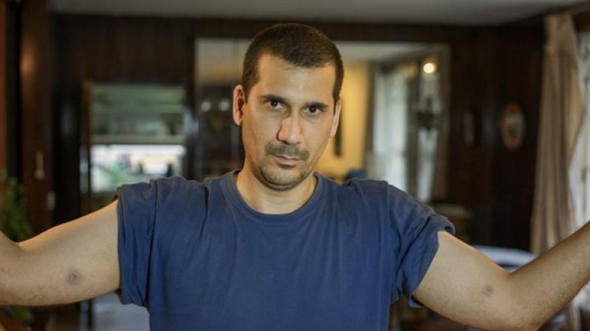Cuban activist Antonio Rodiles, who traveled to the U.S. on Thursday for medical examination after reporting being violently pinched during a Sunday protest.