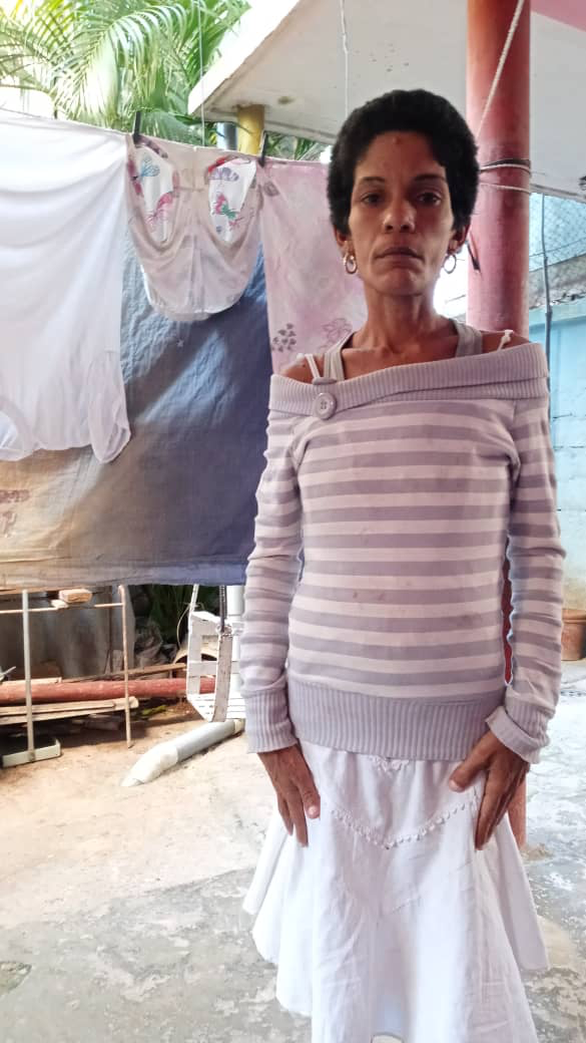Bárbara García Jiménez, a Havana resident, says she has not received treatment for her genetic disease in several years. “Here, if you don’t have money, you have nothing,” she told the Miami Herald.