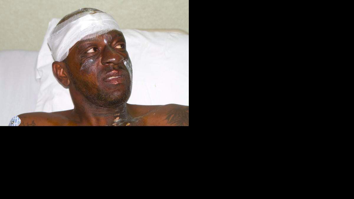 
Singer Darinus Daniel, whose stage name is "Fantom," from the Barikad Crew music group, talks with journalists from his hospital bed in Port-au-Prince, Haiti, Wednesday, Feb. 18, 2015. Daniel is recovering after being shocked by high-voltage wires during Tuesday's Carnival parade. 
