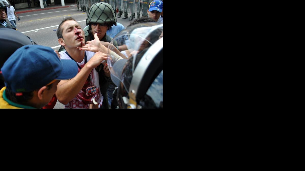 
Members of the national guard help an injured student during a protest against Venezuelan President Nicolas Maduro's government in San Cristobal, Venezuela on February 12, 2015. 
