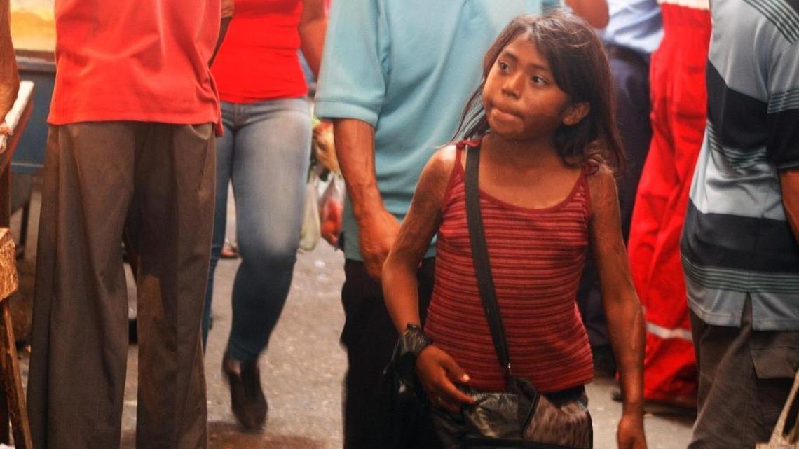 To eat in Venezuela, children work and beg on the streets - to feed their families