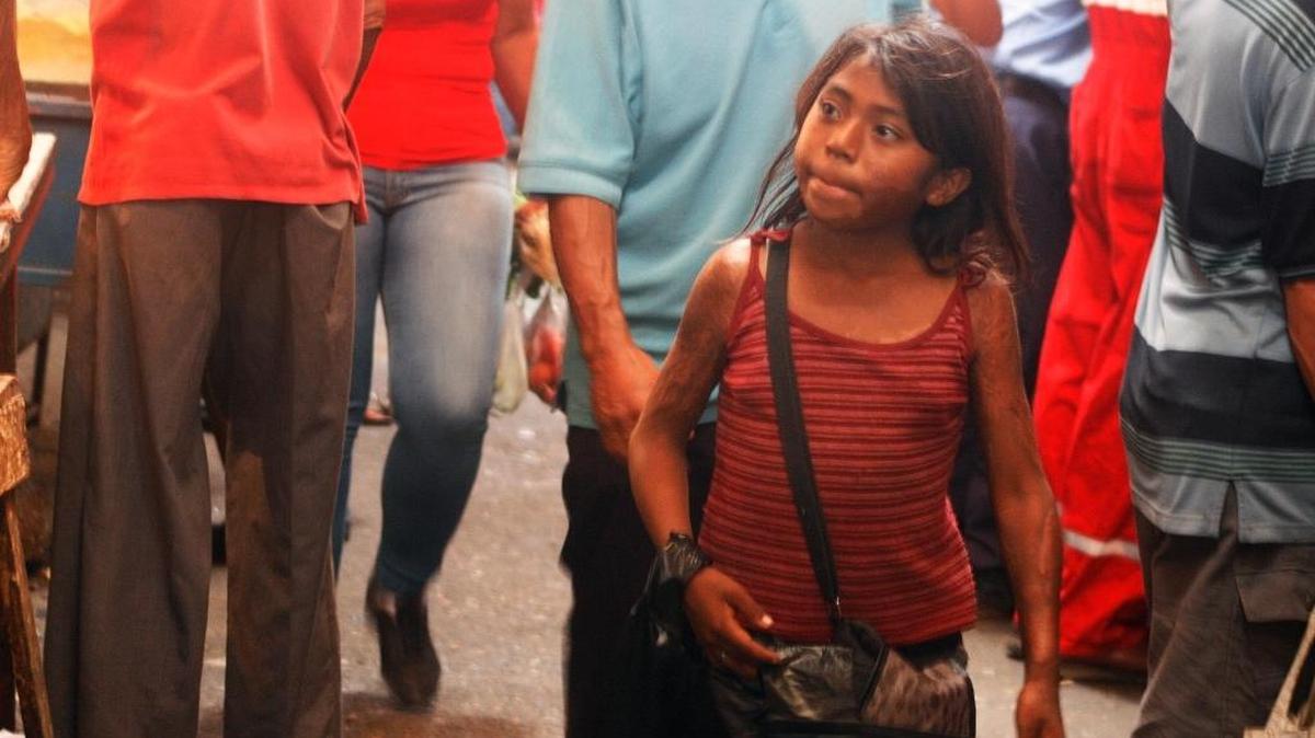 To eat in Venezuela, children work and beg on the streets - to feed their families