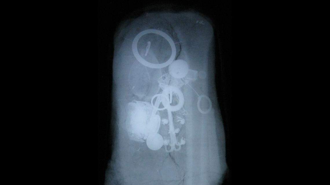 Archaeologists excavated an ancient Roman burial in Pförring and found a belt hung with keys, coins, a snail shell and other artifacts, photos show.