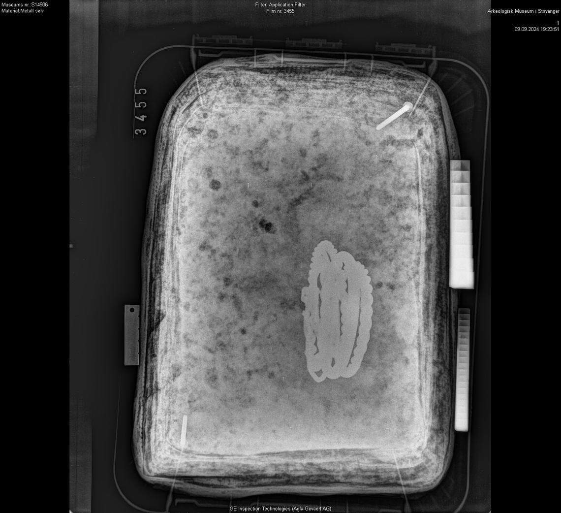 An X-ray shows the ancient Viking bracelets.