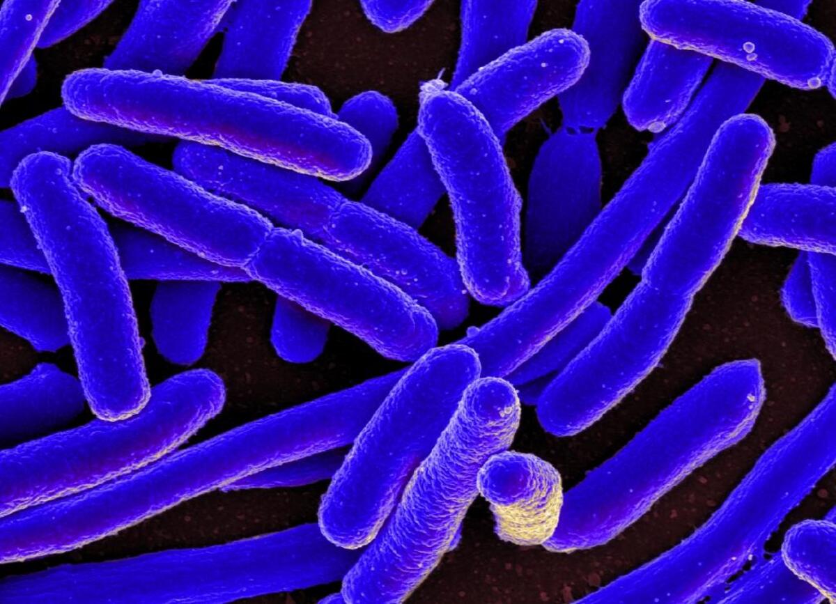 E. coli is a type of bacteria found naturally in the human body, but some forms make people sick.