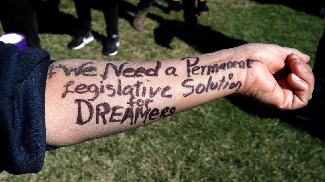 Ivon Meneses, of Las Vegas, had written ‘we need a permanent legislative solution for Dreamers,’ on her arm as she and other supporters of the Deferred Action for Childhood Arrivals (DACA) program attended an action in support of DACA recipients on Monday, March 5, 2018, on Capitol Hill in Washington.