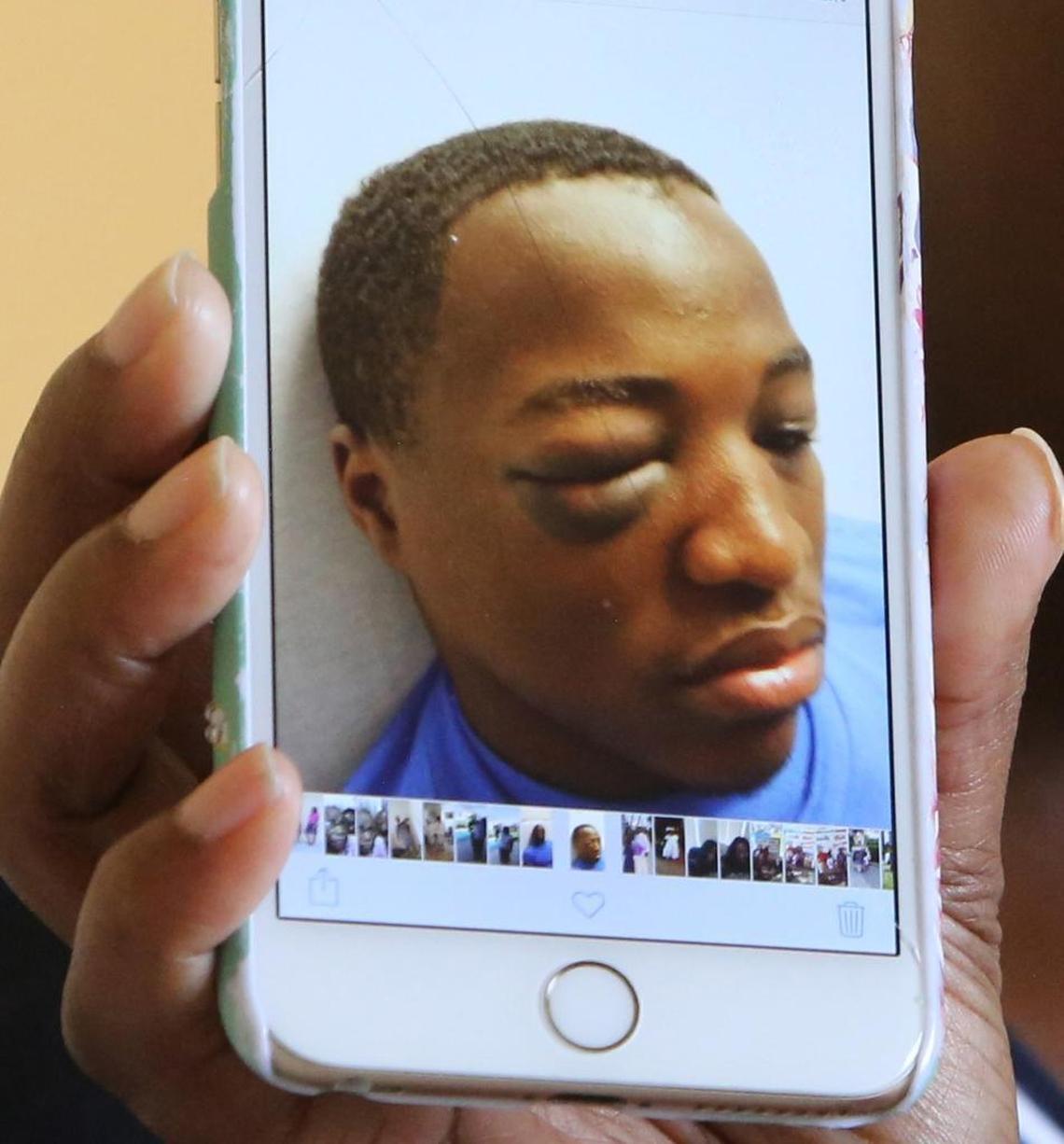 Mary Ables’ son, Rashad, was badly beaten during a fight set up by guards at a youth prison in West Palm Beach.