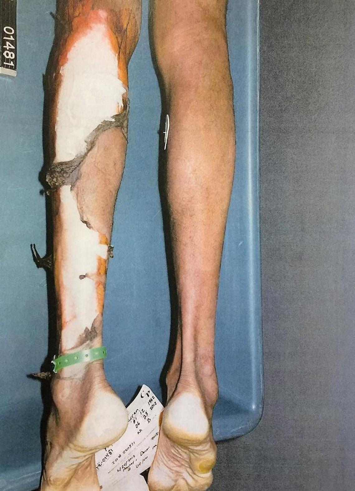 The shower in the mental health unit at Dade Correctional Institution stripped the skin off of Darren Rainey’s body after he collapsed.