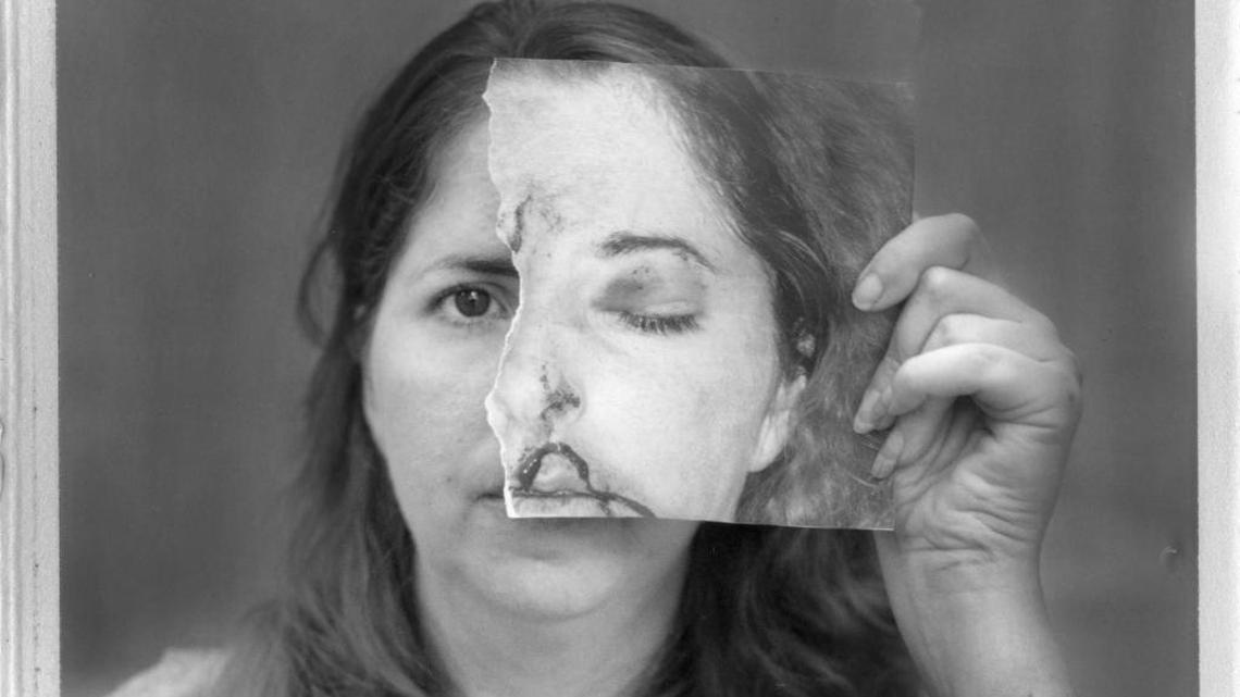 Tonya Cook poses recently with a police evidence photo taken the day she was attacked during her shift at North Florida Evaluation and Treatment Center in 2012.