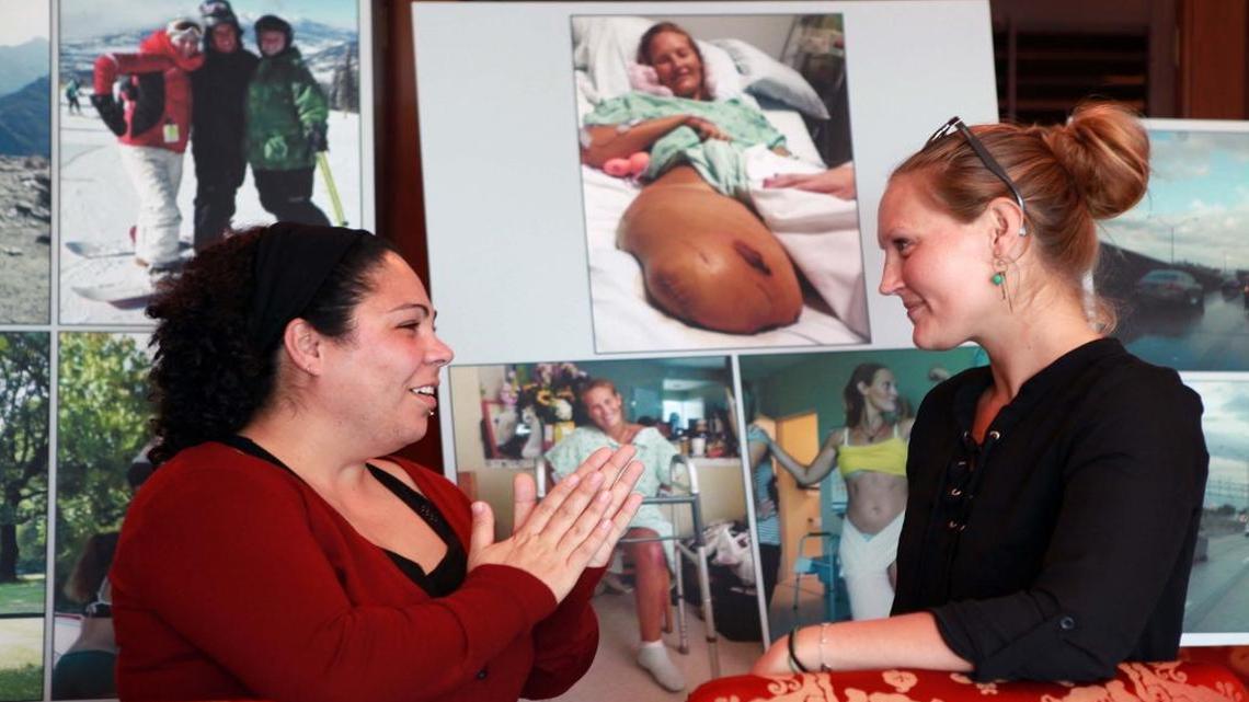 Cathy Milagros Perez Garcia, left, and her friend Cynthia Fleischmann, both involved in an accident in which Cynthia lost her right leg talk during a press conference held Tuesday, Feb. 14, 2017, in Coral Gables. The two crash victims sued the Florida Department of Transportation and a contractor, accusing them of negligence in the maintenance and safety of the express lanes after they were involved in a lane-diving crash.