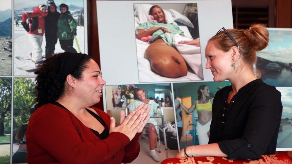 Cathy Milagros Perez Garcia, left, and her friend Cynthia Fleischmann, both involved in an accident in which Cynthia lost her right leg talk during a press conference held Tuesday, Feb. 14, 2017, in Coral Gables. The two crash victims sued the Florida Department of Transportation and a contractor, accusing them of negligence in the maintenance and safety of the express lanes after they were involved in a lane-diving crash.
