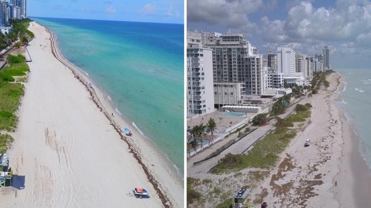 This images shows the significant erosion that occurred during Hurricane Irma near 53rd Street, where the U.S. Army Corps of Engineers completed a $11.5 million widening of the beach earlier this year.