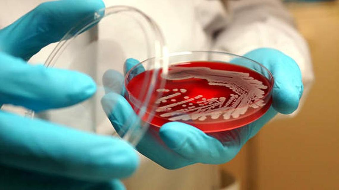 Study from Pakistan raise concerns of an antibiotic-resistant strain organism.