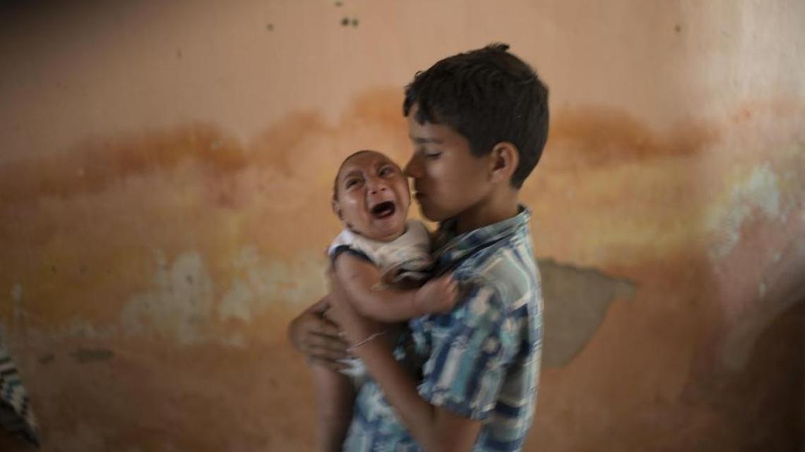 Elison holds 2-month-old brother, Jose Wesley, born with microcephaly, in December at their home in Brazil.
