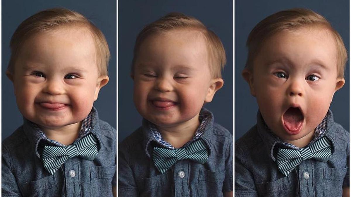 Asher Nash was accepted as model in an ad for OshKosh B’gosh clothing.