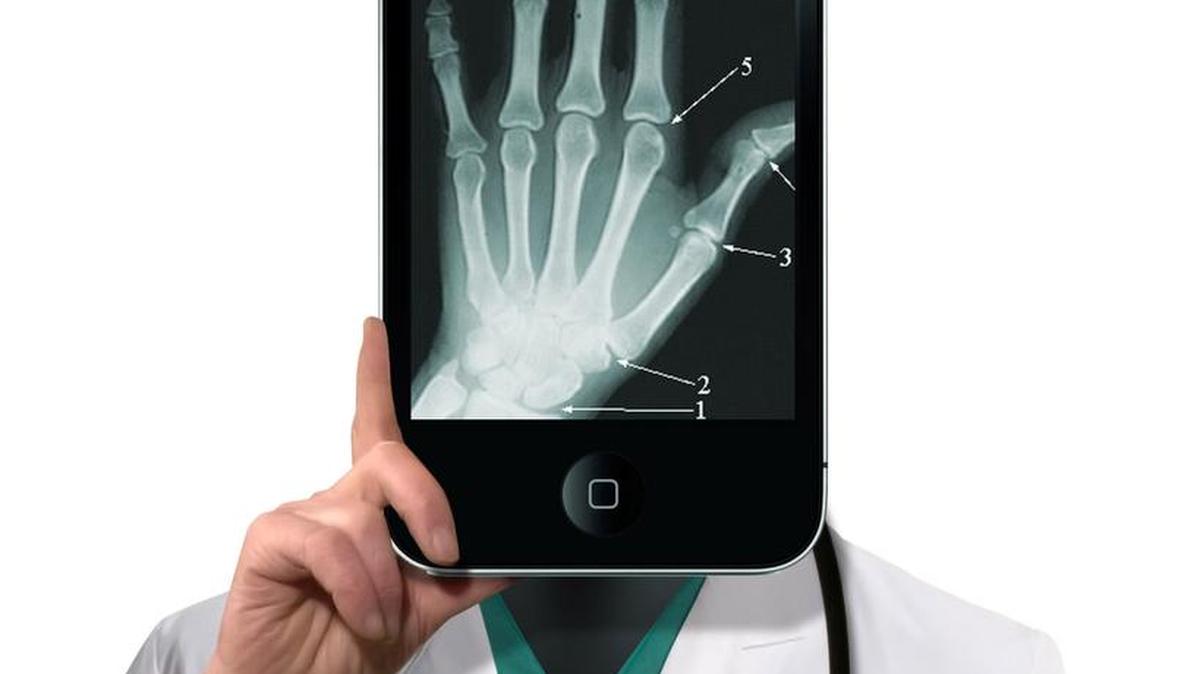 Carpal Tunnel Syndrome can cause numbness, burning or tingling in your hand.