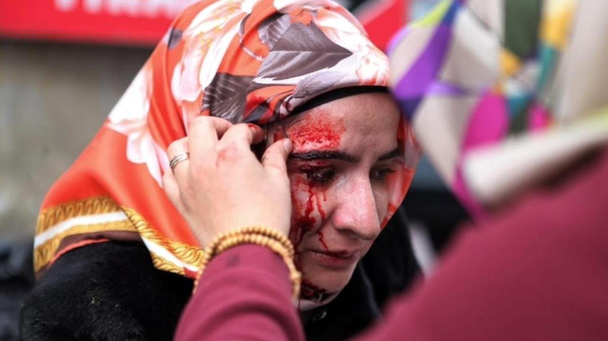 A woman was among those injured when Turkish police broke up a demonstration in from of a government-seized newspaper.