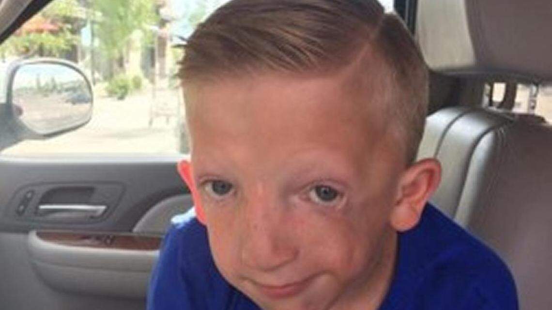 Dan Bezzant wrote a Facebook lament that his son, Jackson, above, who has Treacher Collins syndrome, is bullied.