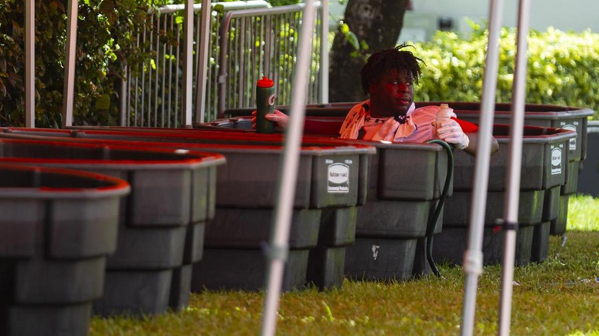 University of Miami defensive tackle Tito Odenigbo (94) sits in an ice tub during the first day of fall training camp at the Greentree Practice Field a week ago. Odenigbo, a transfer from Illinois, has been the surprise of training camp, according to defensive coordinator Manny Diaz.